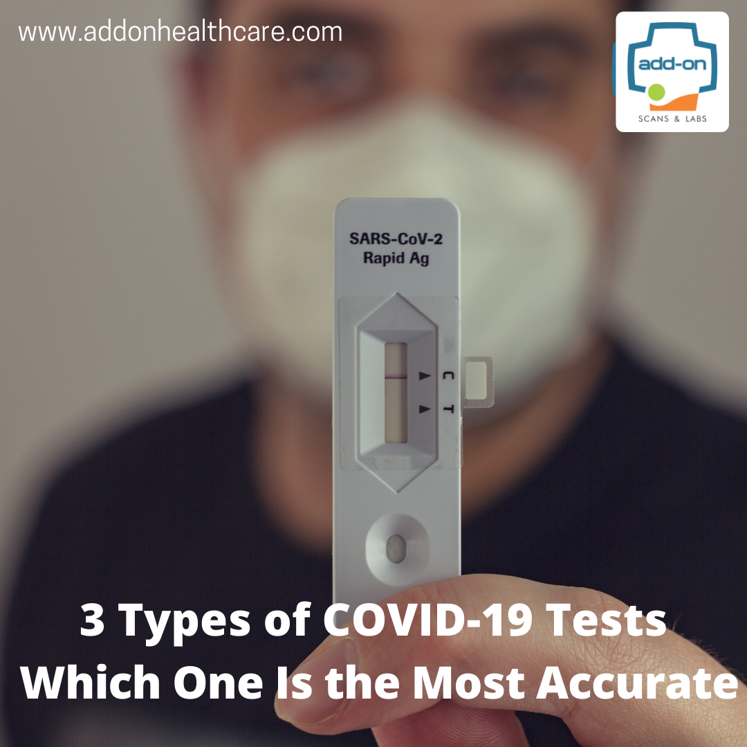 reporting of covid test
